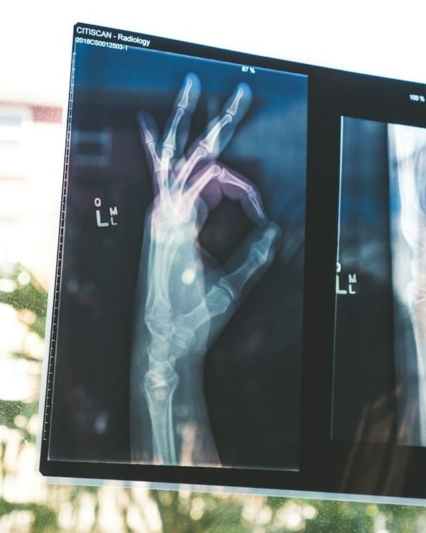 What are the emerging trends in ai-based health diagnostics?